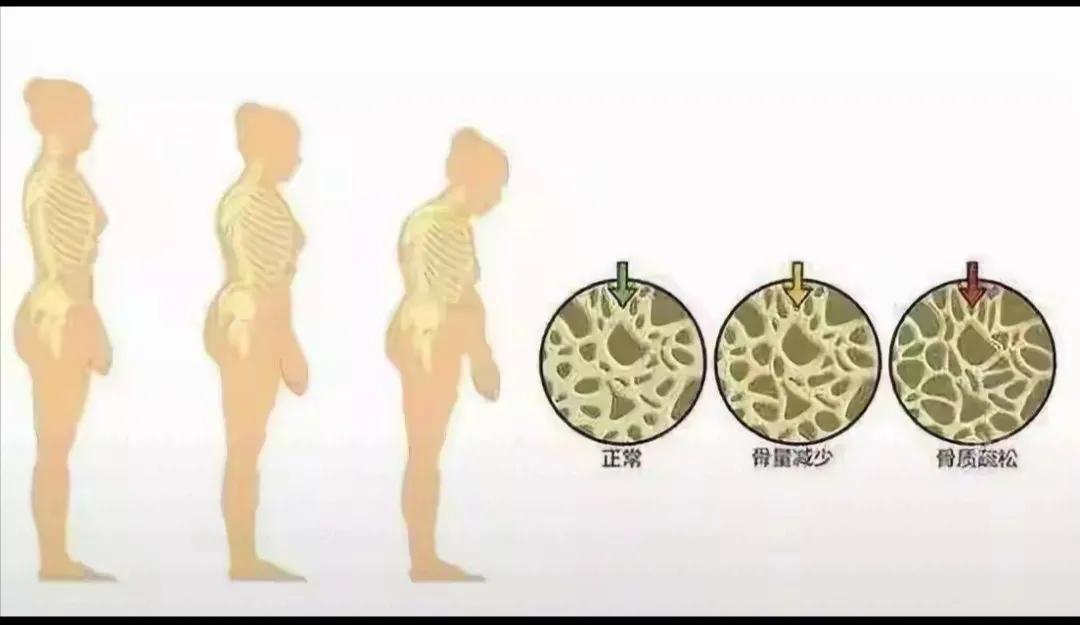 到了50岁要关注3种常见疾病。各位年满50岁的姐妹们呀，可得好好关注一下这三种常