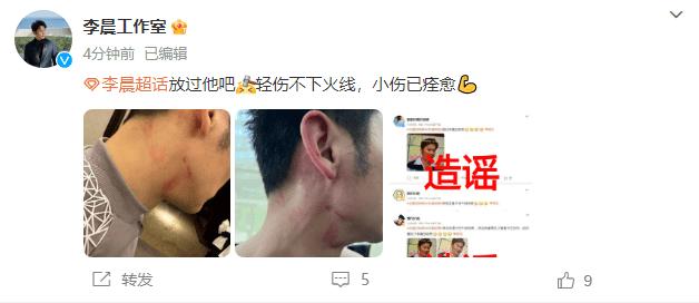  5月8日，李晨工作收发文否认所谓的脖子吻痕，并表示其实为3月录制节目过程中的小