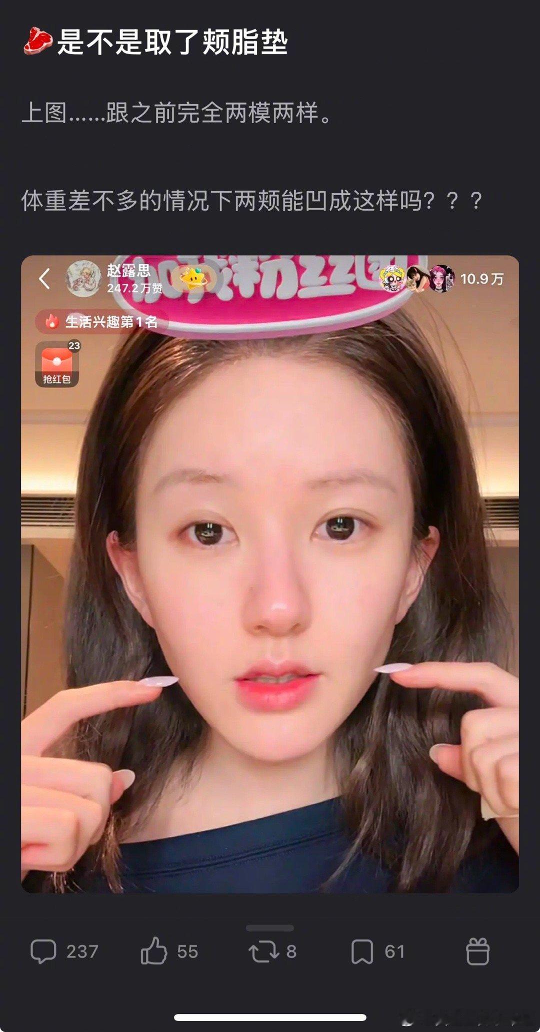 赵露思的脸跟之前完全两模两样了吗？ 