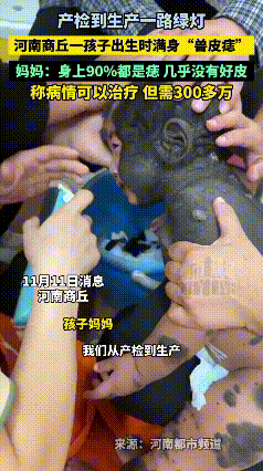 “产检一路绿灯，却换来宝宝满身‘兽皮’！”
河南一名宝妈满心期待迎接新生儿，所有