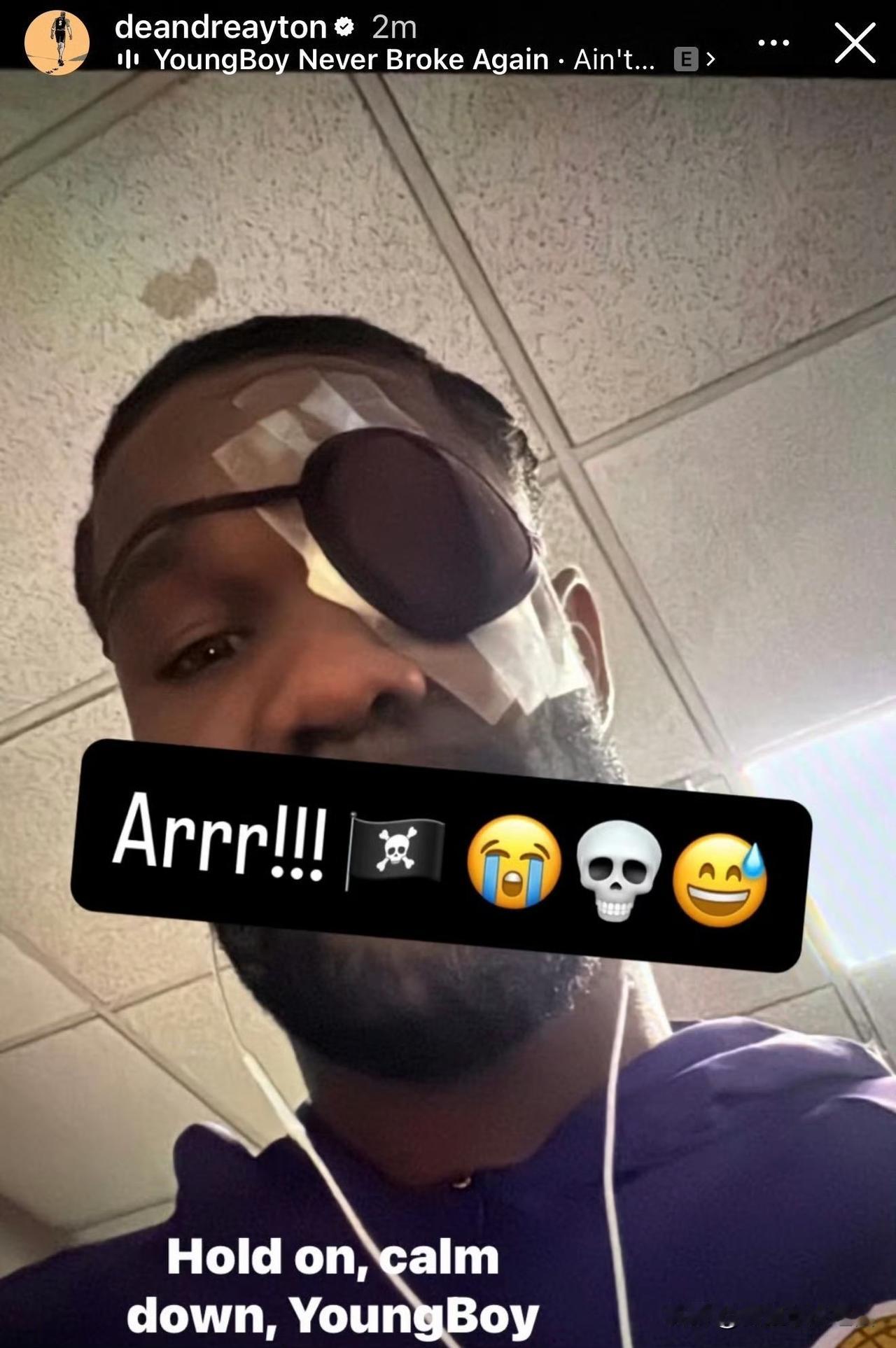 心酸又好笑！湖人主帅雷迪克在采访时说球队中锋艾顿现在的造型是“加勒比海盗”，还以