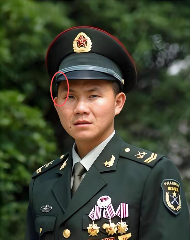 2007年，士兵卢加胜在训练时额头上的疤痕引起了军队政委的注意，在一系列询问后，