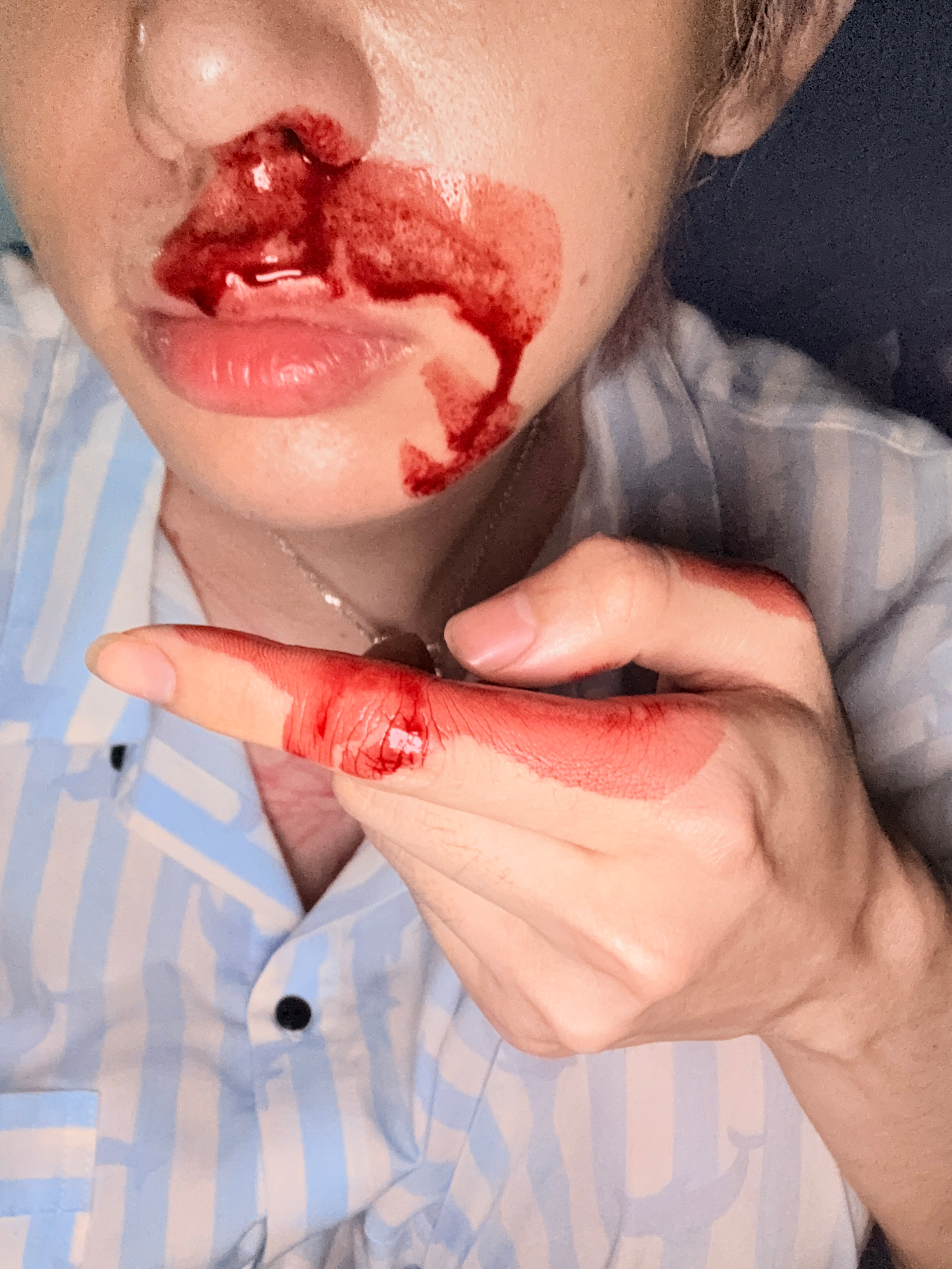 刚睡醒突然喷鼻血了 