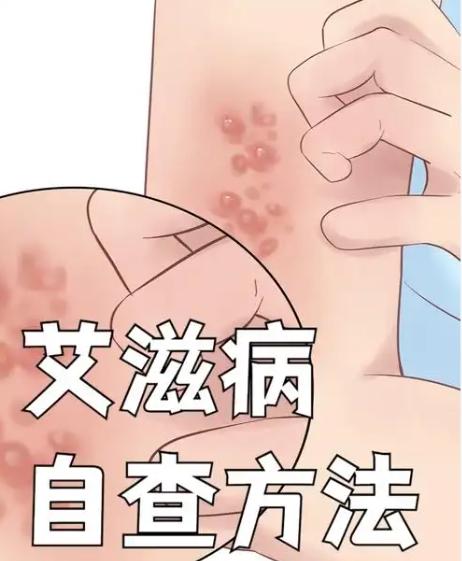 [浮云]性病专家的炸弹消息，看完后背发凉！艾滋病最高发的地方，根本不是你想的那些
