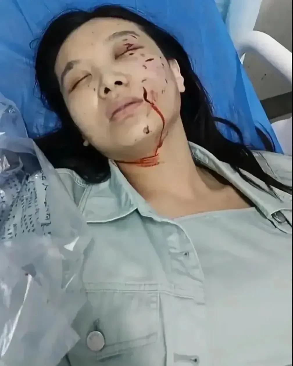 有的人居然建议将宠物看病纳入医保，很多穷人连病都看不起，居然提这样的建议，真是无