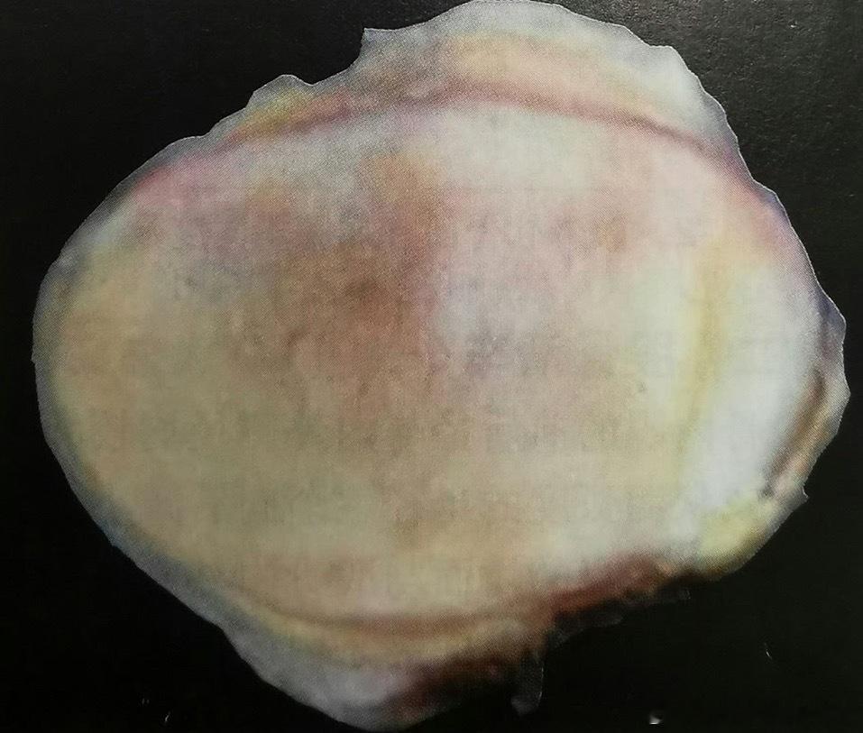 运动康复    来考考课代表们，这个是什么？（不论是损伤还是科普，我经常提到的一