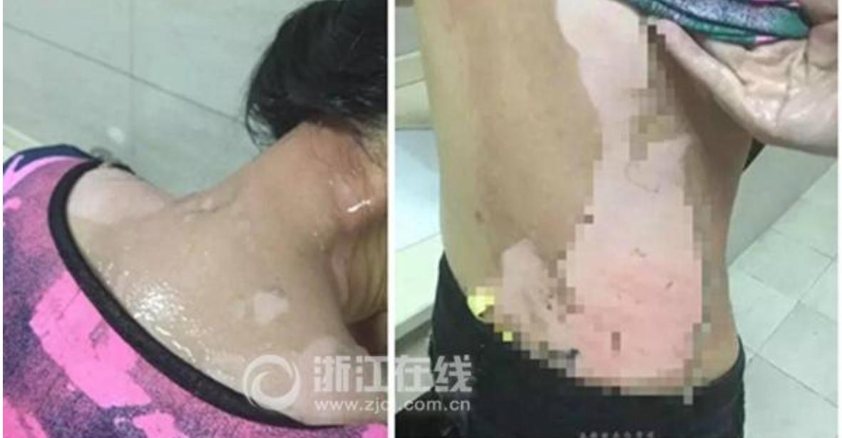 这就是嘴欠的代价！浙江，女子吃火锅喊服务员加汤，17岁的服务员没有及时过来，女子