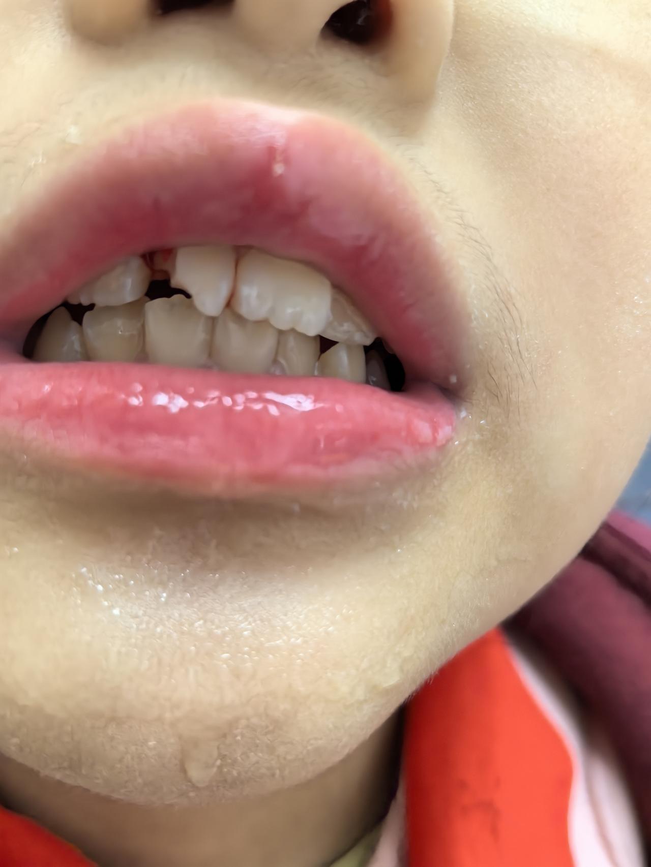 得了重病，该看医生就看医生，因为没有真的‘病’，没有真的‘病人’，也没有真的‘看