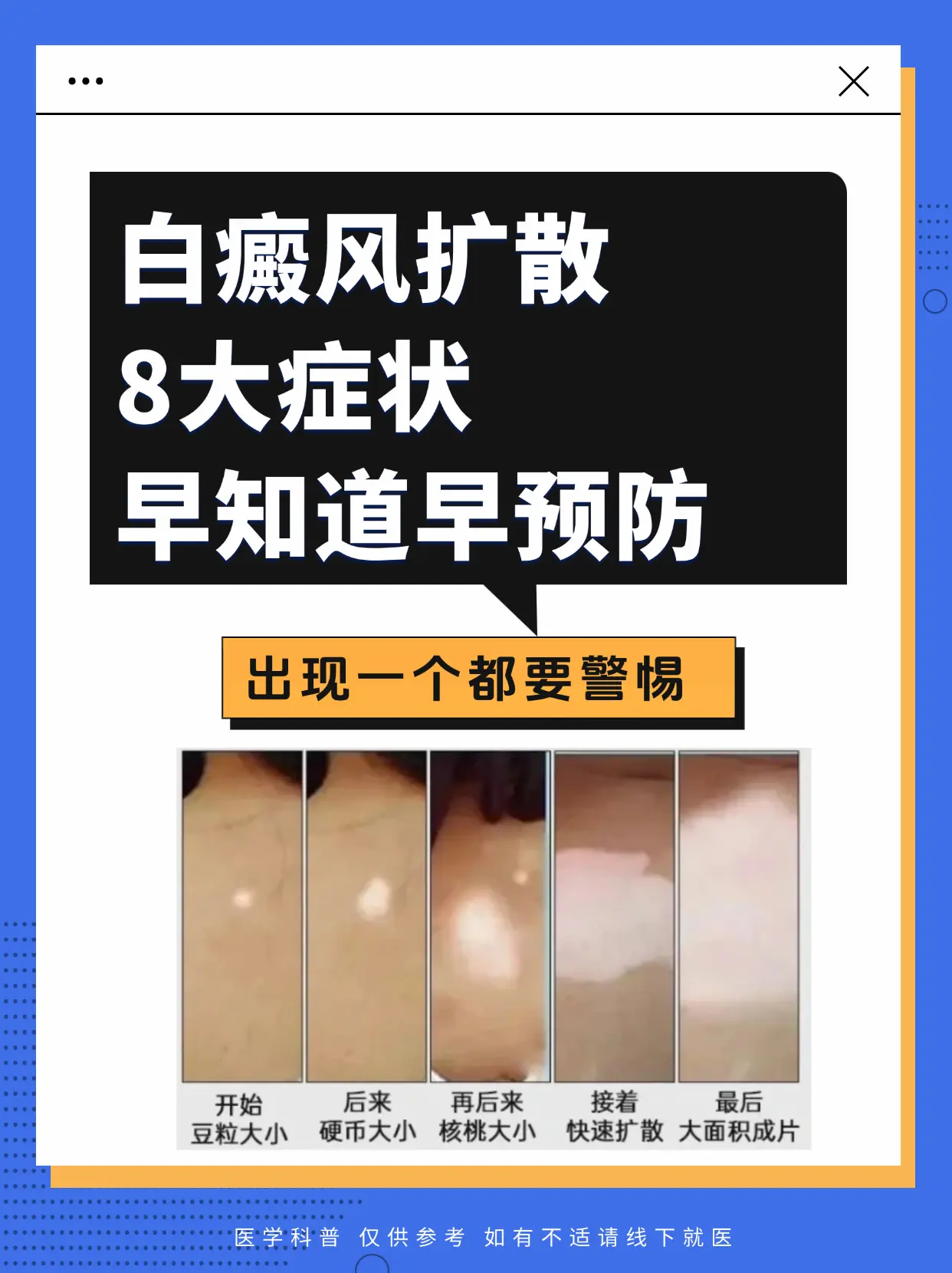 医学科普 白癜风 白癜风科普 白癜风扩散 抖出健康知识宝藏