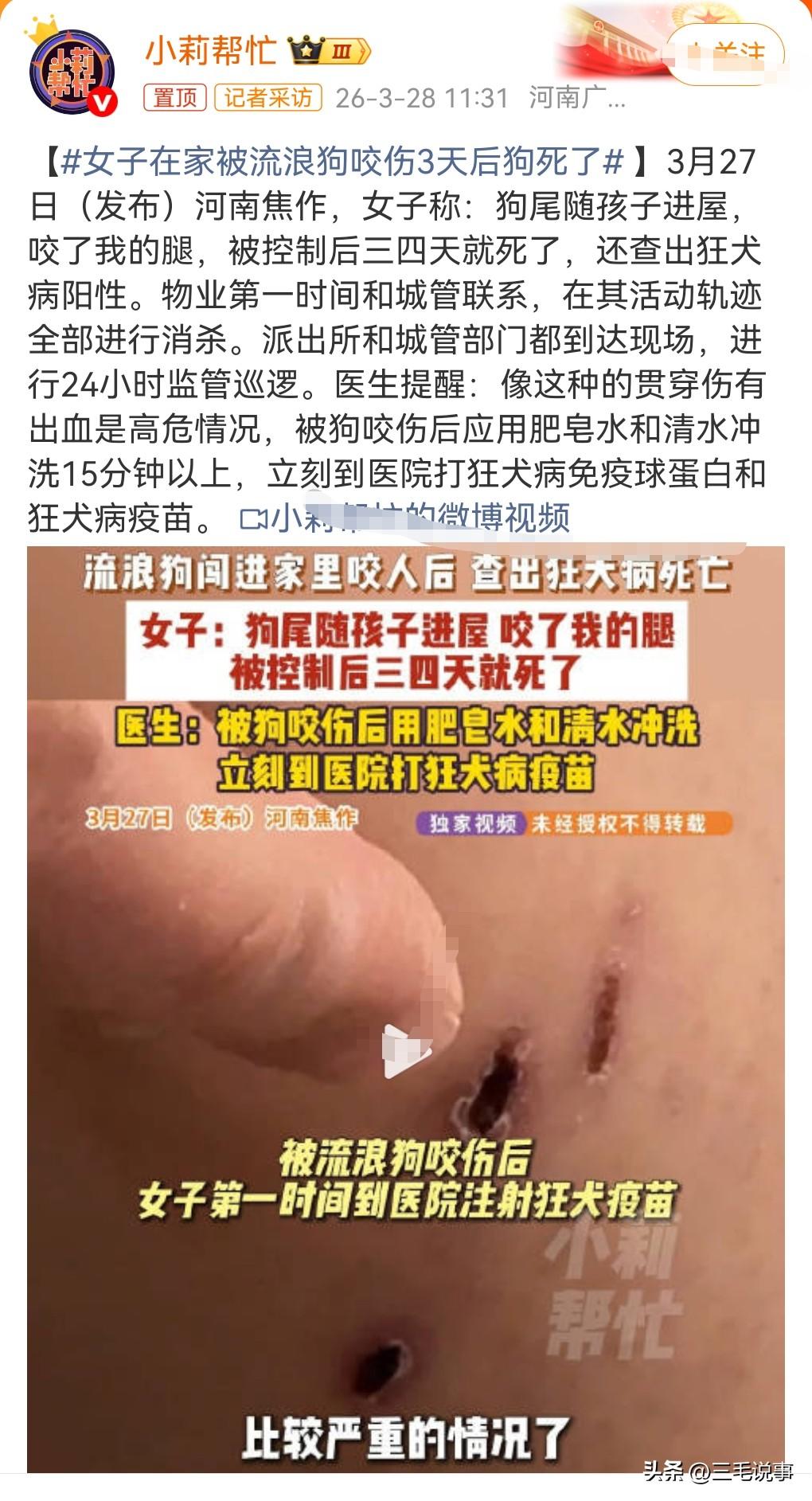 3月28日热搜，女子在家被流浪狗咬伤，3天后狗死了。这是发生在河南焦作，有一个狗
