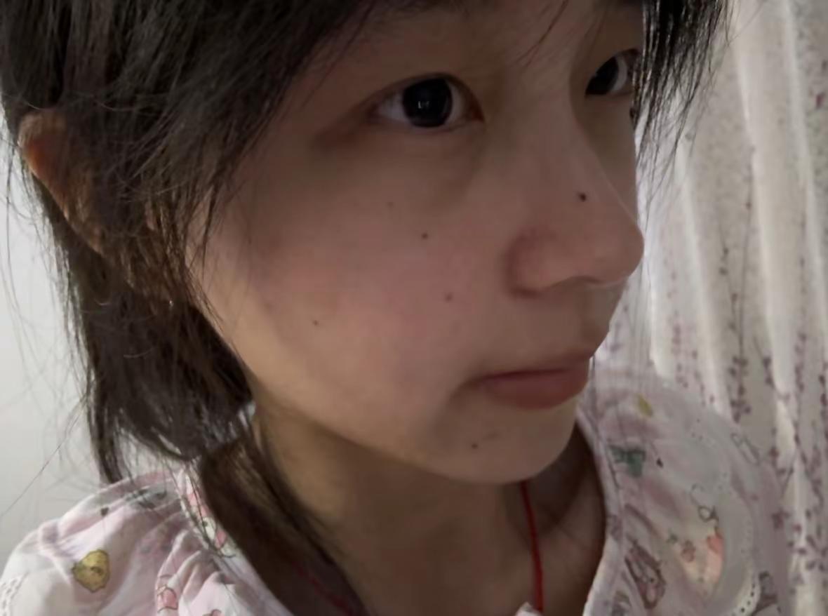 黑眼圈。眼袋。坏皮肤。799