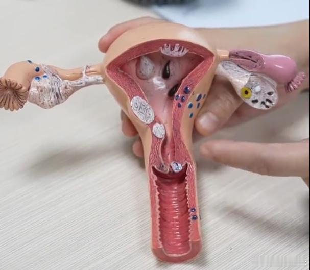 切了子宫的女性会怎么样 某次和我妈聊到这个话题，才知道她身边好多人都切除了子宫，