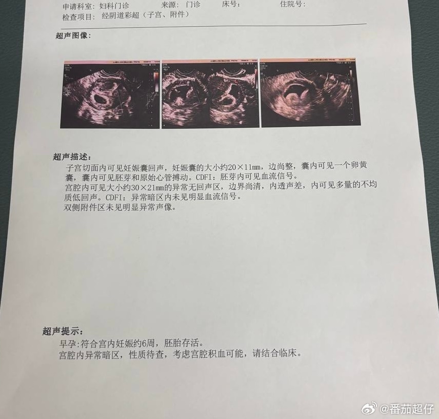 宝宝出胎心了 当爸爸后生活会变得什么样呢？🤔 