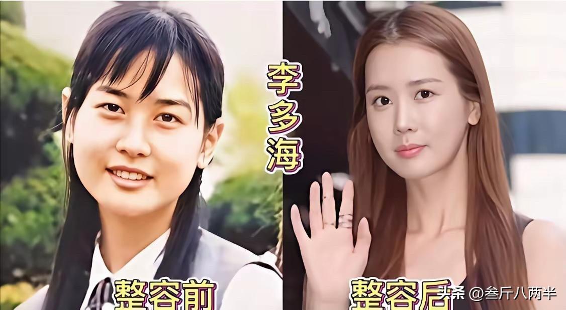 李多海、蔡琳、刘仁娜、朴敏英、郑秀妍、孔孝真——这些韩国女星，整容前和整容后，有