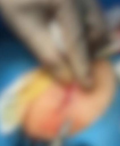 乘客正常投诉绕路竟遭出租车司机铁棍殴打！网约车都配备实时定位了，出租车还几十年一