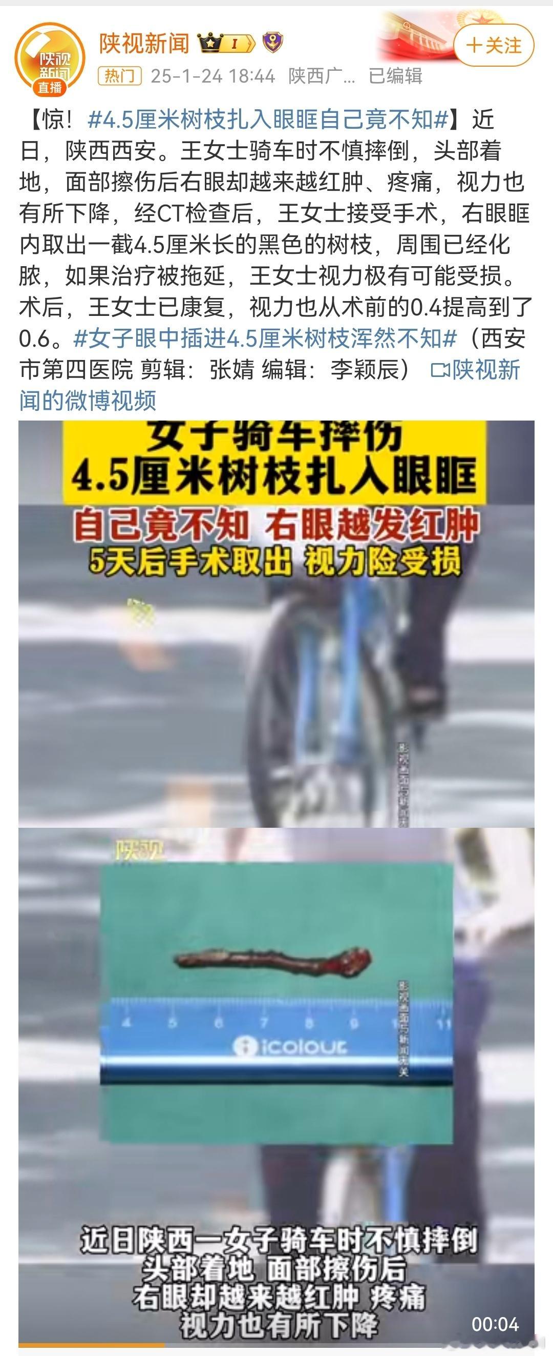 女子眼中插进4.5厘米树枝浑然不知  啊？这么长的一截树枝戳进眼眶，居然不知道？