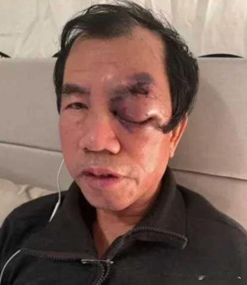 梁新民，曾是中国的富翁，于2015年携带大笔财富举家移民到美国。他在那儿过上了舒