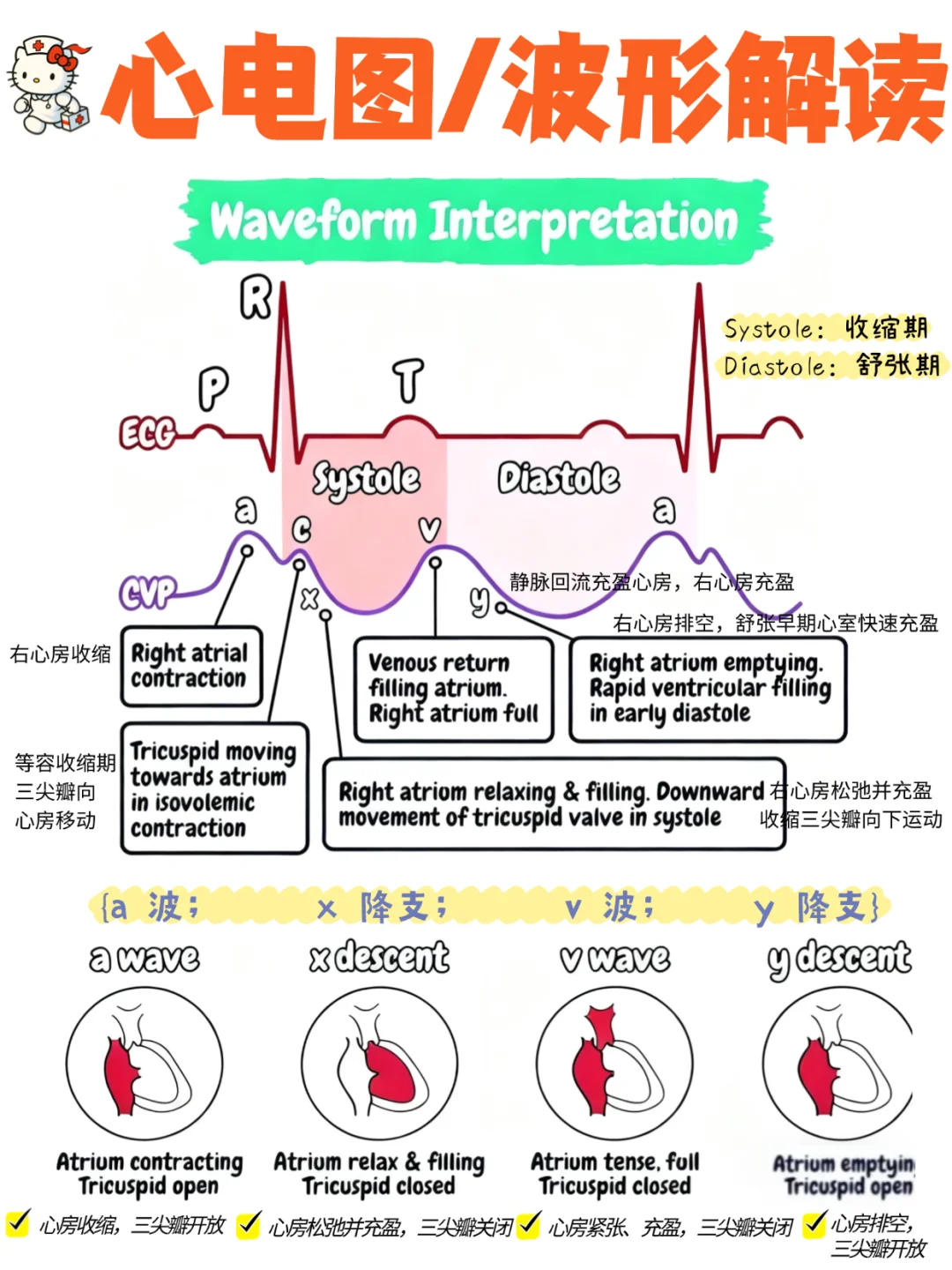 备考RN/心电图波形解读！！学！！内容