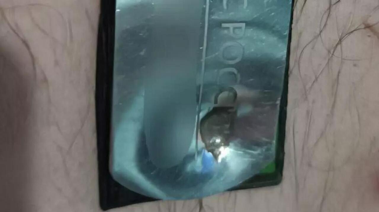 俄军士兵的钢制身份牌挽救了自己的生命

俄罗斯卫星通讯社 2026年1月28日,