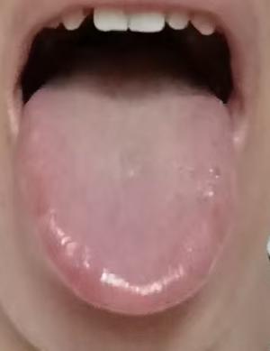 宗筋不振辨证思路：脾虚痰瘀与下焦湿热不容忽视







有粉丝向我倾诉：早年