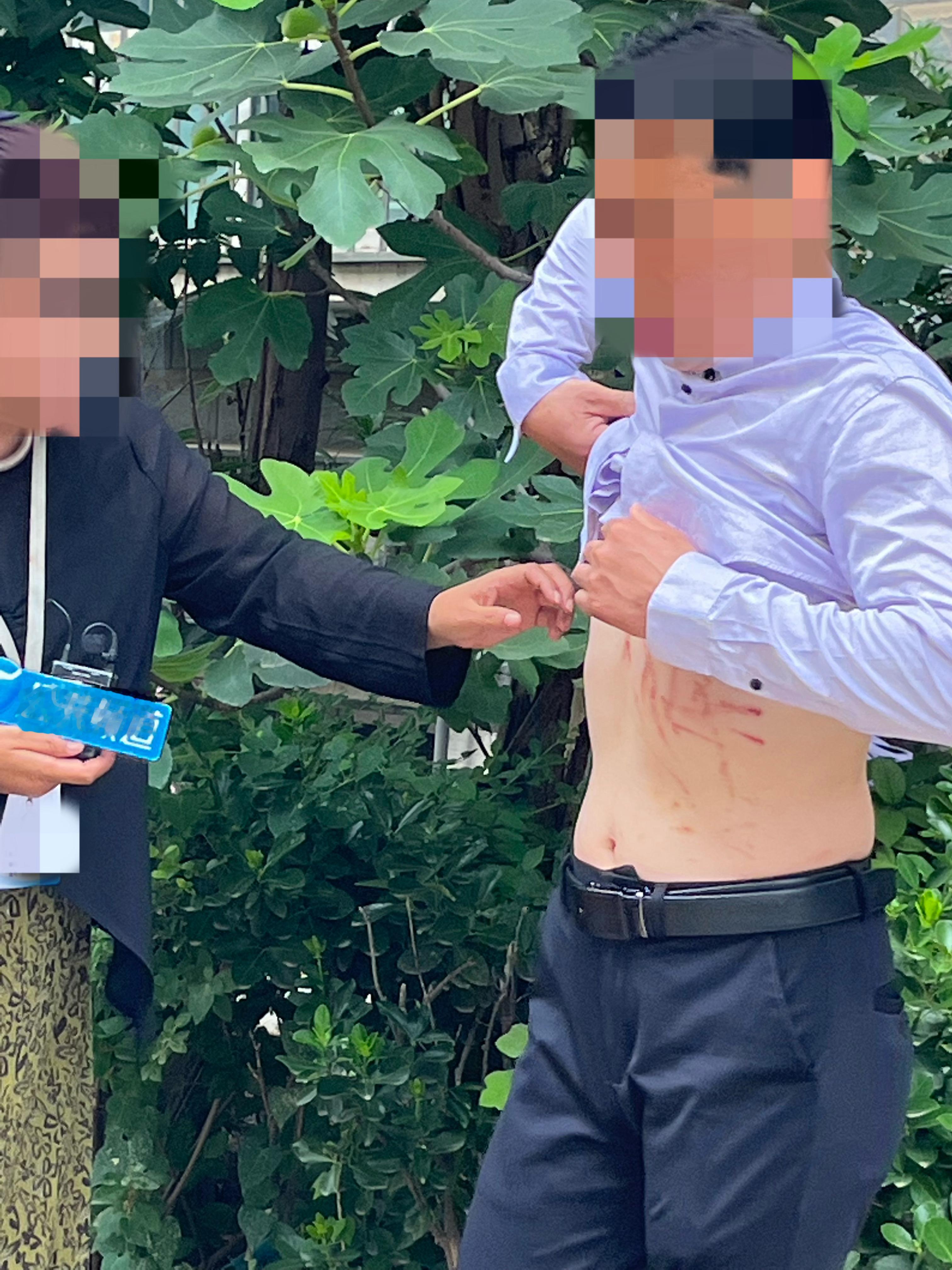 85岁大爷长期被老伴家暴男的被女的家暴，这事也不新鲜我参与的调解就遇到过这样的男