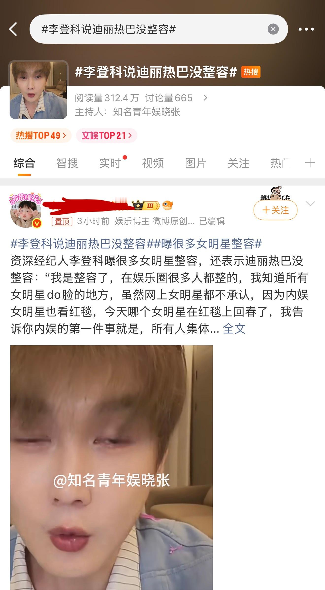 真受不了李登科了迪丽热巴没整容还用你说？？ 
