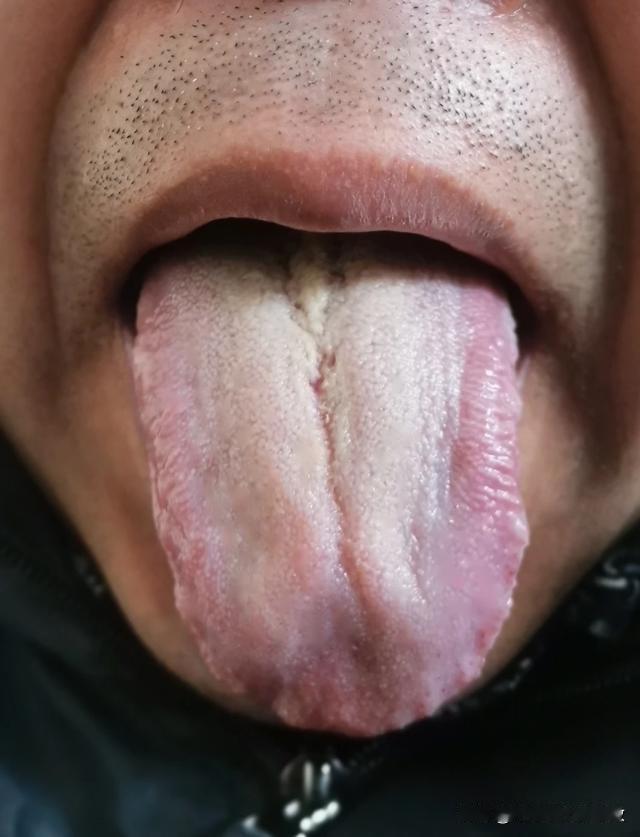 大哥已经快50了，还天天忙这忙那的，把自己身体都给搞垮了[泣不成声][泣不成声]