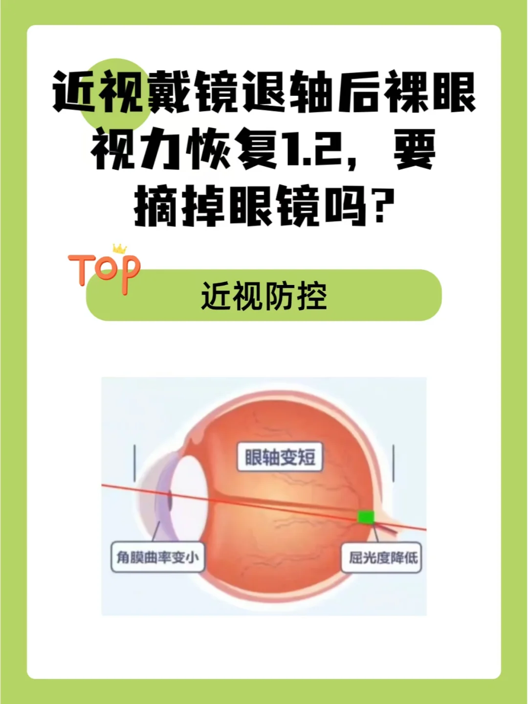 戴镜退轴后裸眼视力恢复1.2，要摘掉眼镜吗