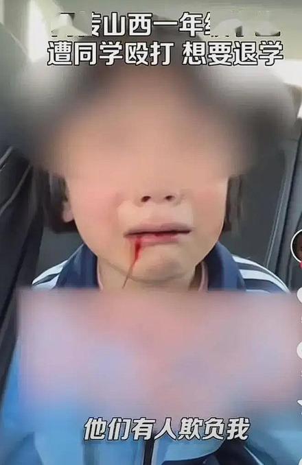 “如不严惩，天理难容！”山西一名一年级学生在放学时，被8名学生殴打，嘴角止不住的