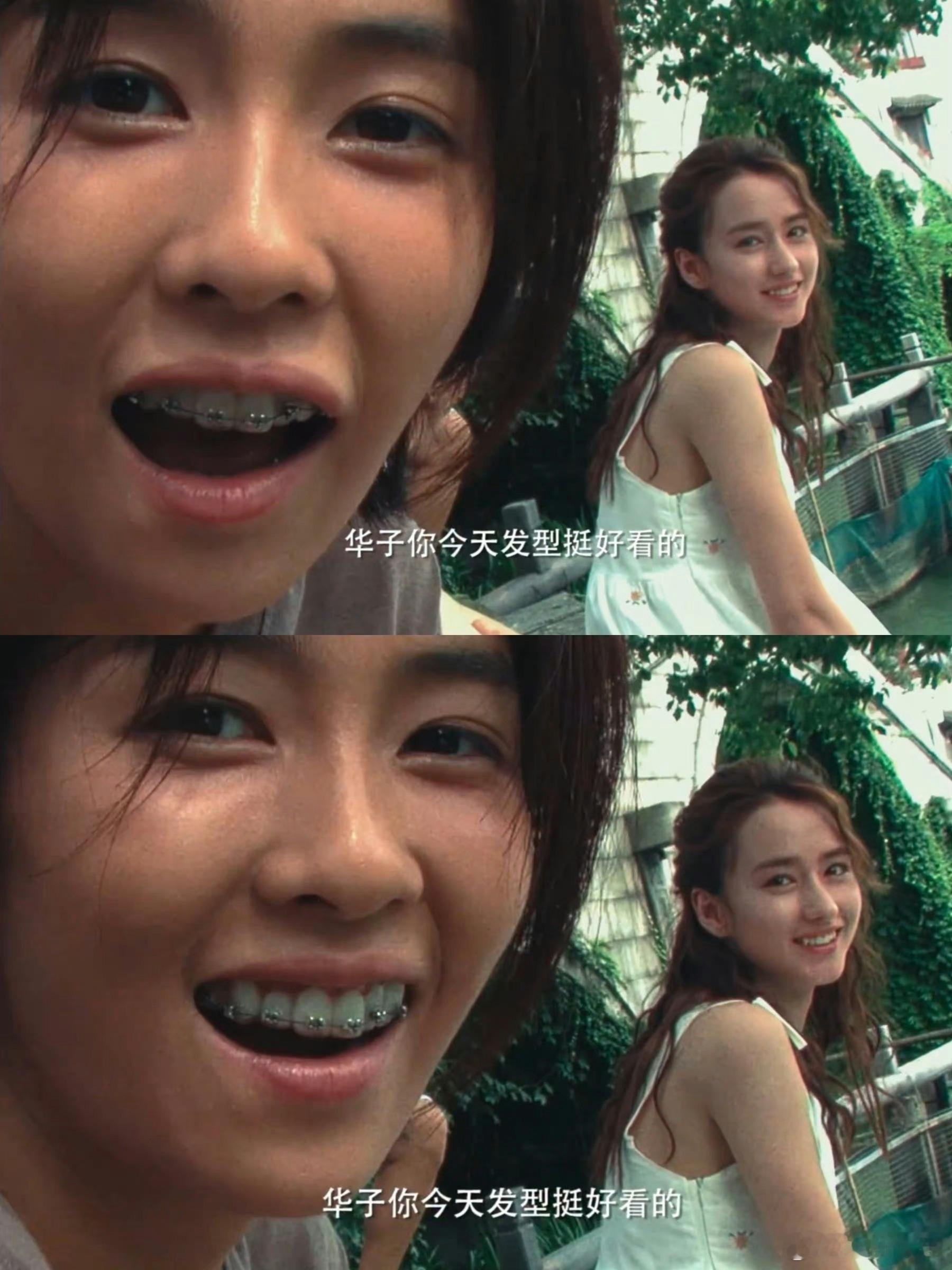 白鹿以前戴牙套的样子确实是有点土了，看来这牙套真的是戴对了 ​​​