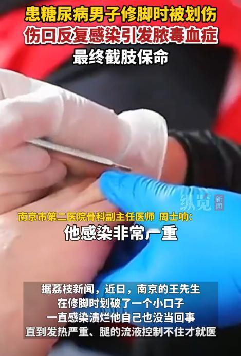 “还敢修脚吗？”南京一男子来到一家足疗店修脚，不料技师在操作时失误，男子的脚上被