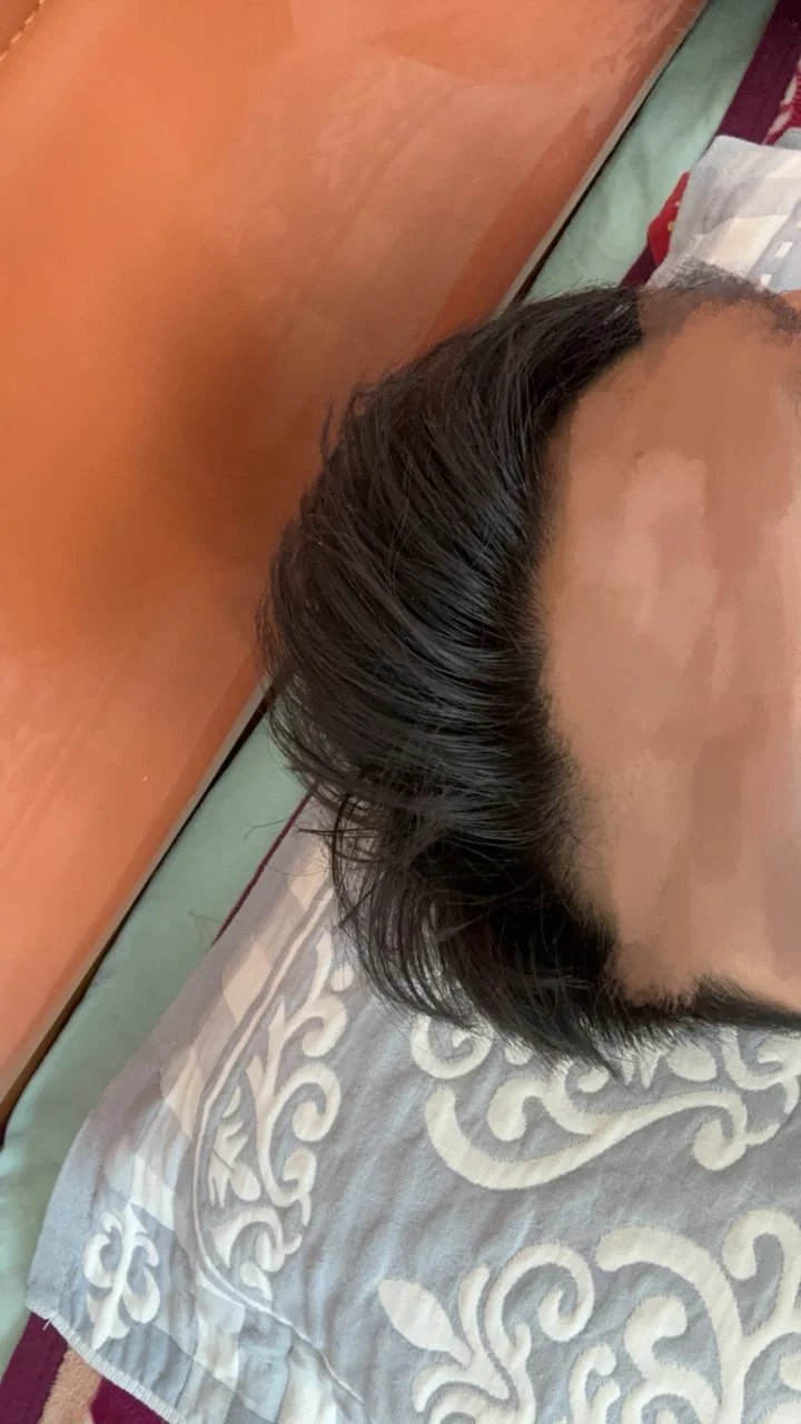 应要求看看发际线💇🏼‍♂️