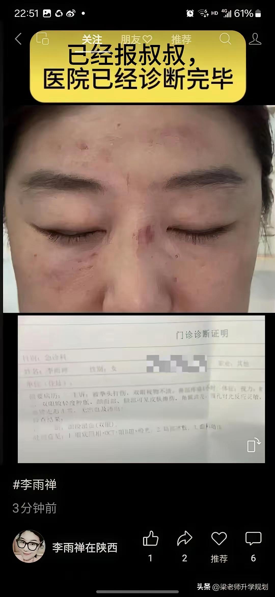 相宜与李雨禅：五年互撕背后的因果局，谁在造孽，谁在渡劫？

从2020年的一句古