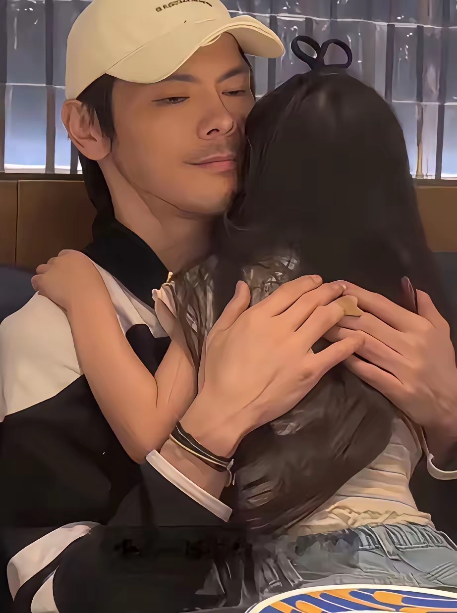 郭碧婷的手上怎么那么多淤青啊？ 
