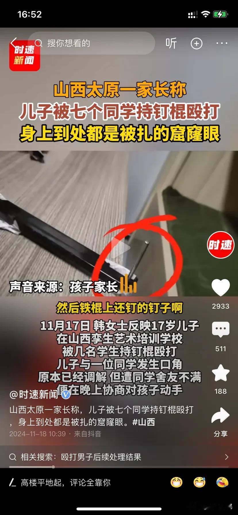 太可恨了！
头脸脖子一个地方一个窟窿！

家长曝17岁儿子被8名学生持钉棍殴打，