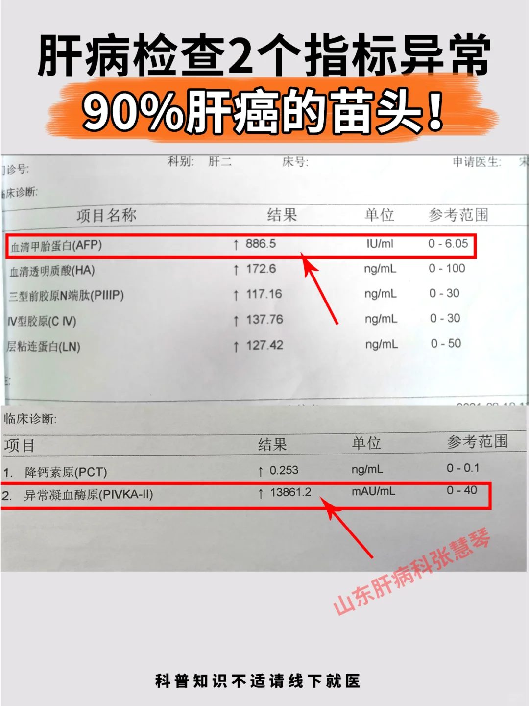 乙肝肝硬化这2个指标异常，警惕肝癌发生！