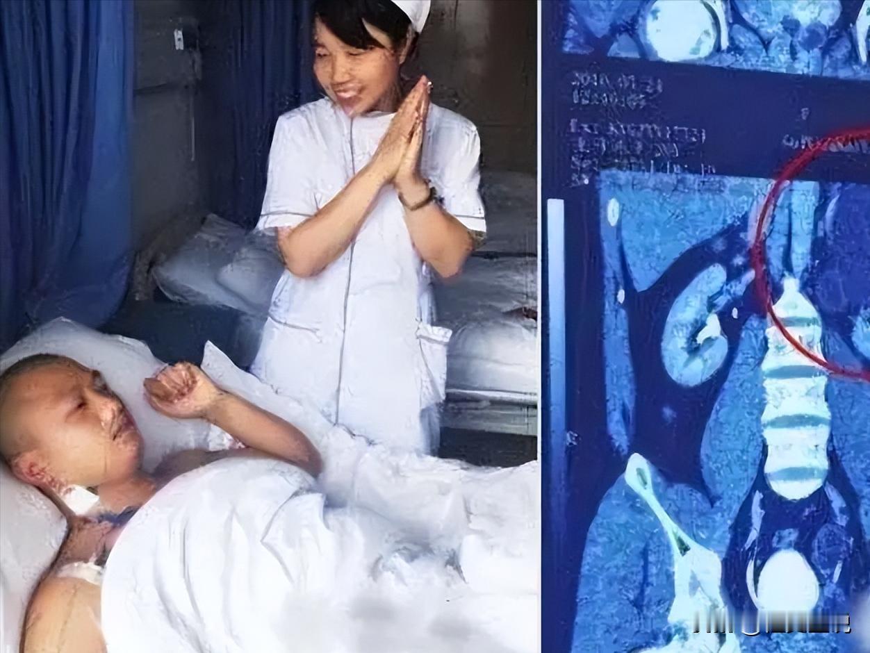 “我的丈夫有4个肾！”2016年，贵州一男子天生神力，可以把白酒当水喝，除此之外