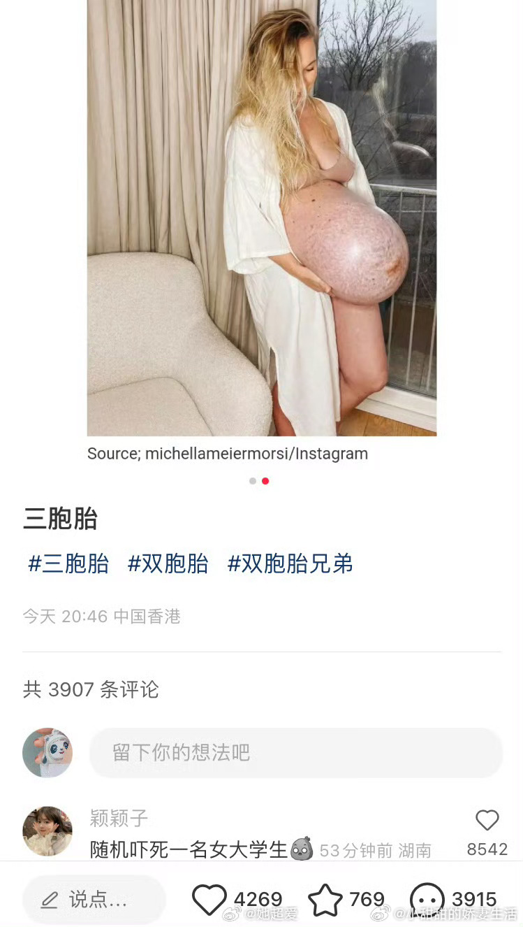 生完三胞胎妈妈的肚子 ​​​