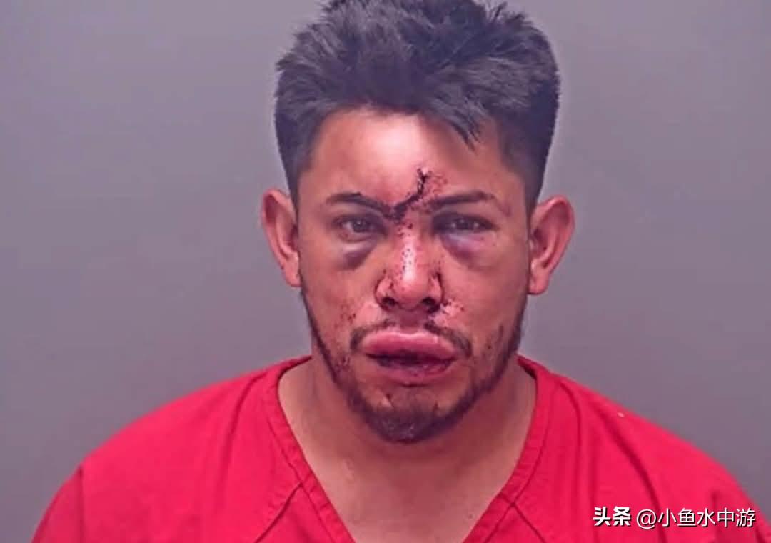 国外13岁男孩为救妈妈，出手打昏了醉酒家暴的父亲！网友：看完照片还是觉得孩子下手