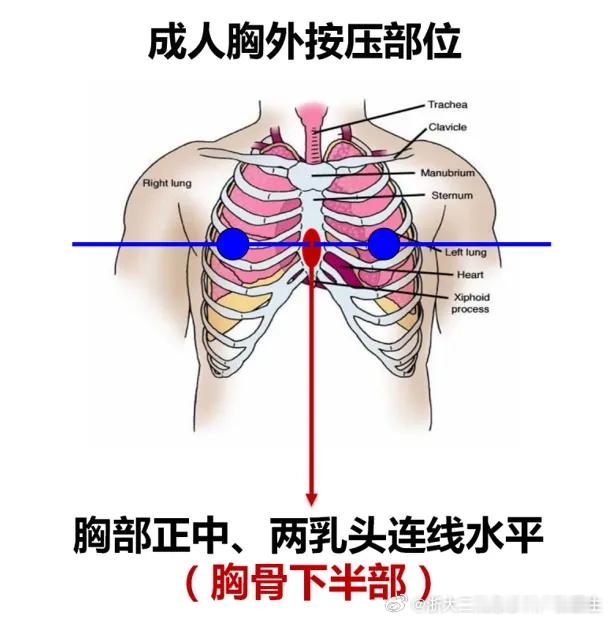 心跳骤停的大叔很幸运，户外运动过程中突发心跳骤停，三天治疗后就生命体征平稳，神智