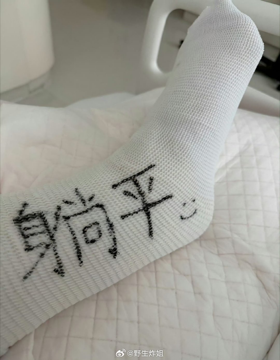 我的天啊，陈妍希在运动的时候，不小心给自己给整成跟腱断裂了，这也是直接喜提石膏了