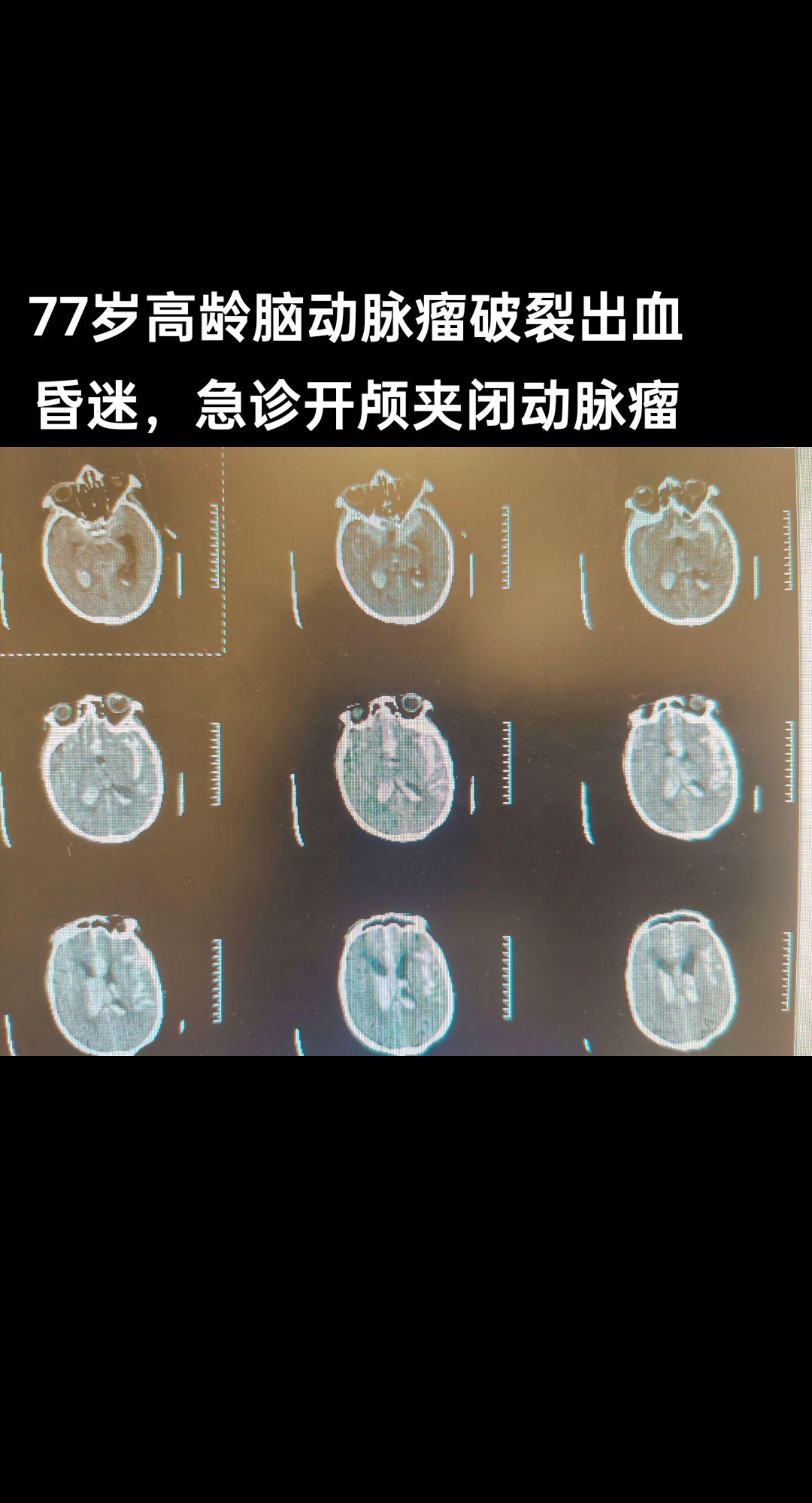医生日常 医路前行 医者仁心