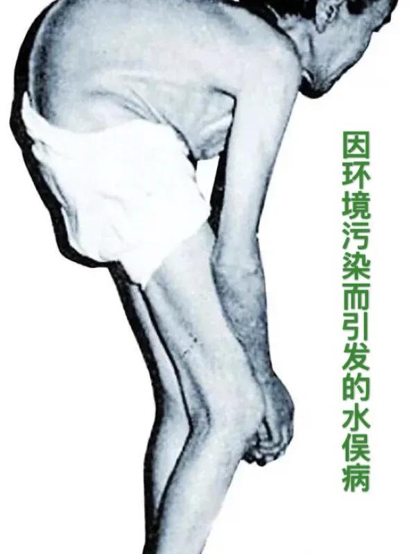 日本核污水排放，可能只有我们中国才会面对这个问题，就像一个潘多拉魔盒！

小日本