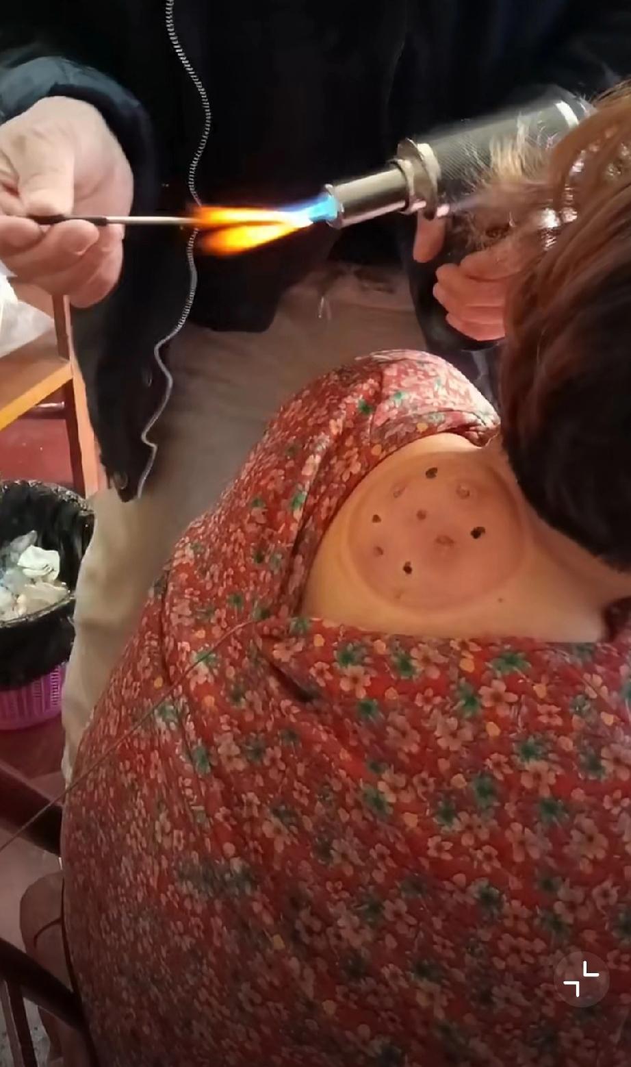 民间偏方出手太狠了，大娘这都不吭一声。。。老一辈的小偏方 民间土偏方 老祖宗小偏