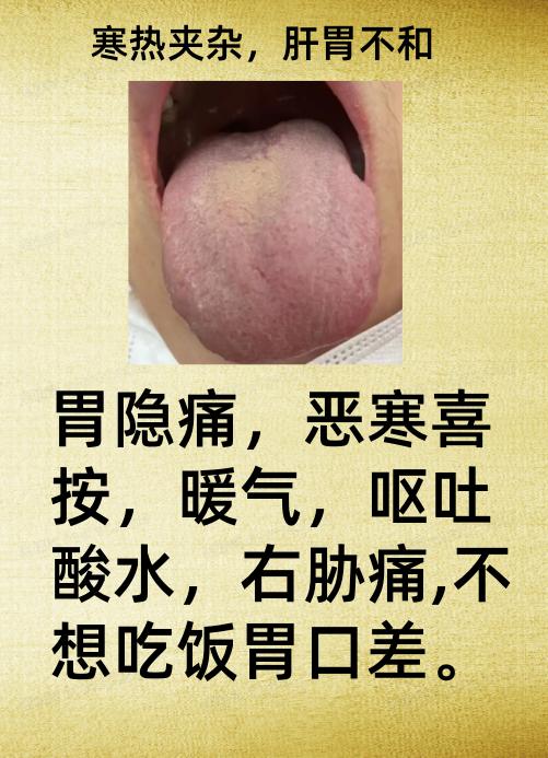 多年胃病，感觉自己已经习惯了，看看下面这位女士，脾胃病不管，带来的对生活的不适。