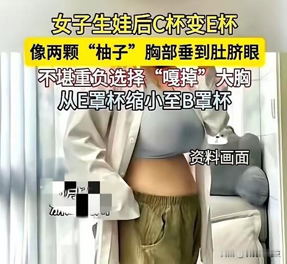 😰杭州妈妈C杯变E杯，勒痕渗血！切除3斤后，她终于“卸了盔甲”

杭州32岁赵