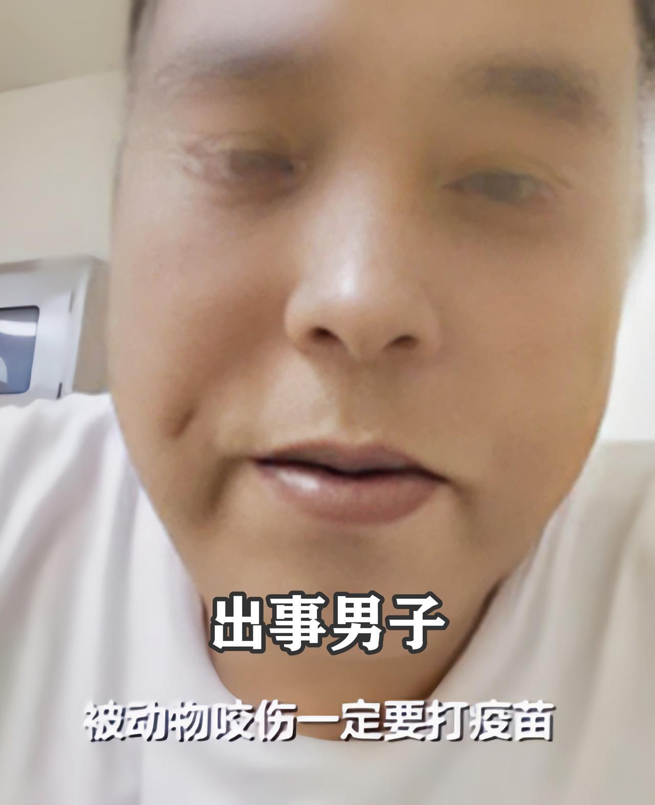 湖南浏阳，一男子意外被狗咬伤，伤口破皮出血，却心存侥幸，为了节省费用，既没有及时