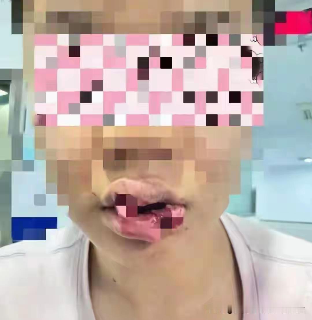爱狗人士不是把宠物狗当儿子当家人吗？大多数人都认为，亲儿子绝对不会把他妈嘴唇咬豁