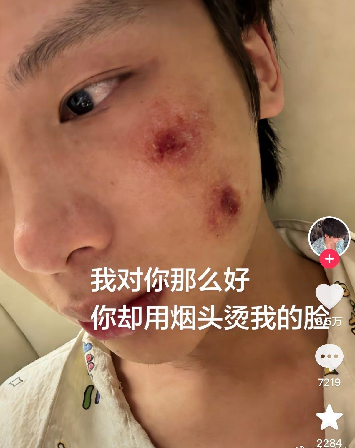 家暴不是性别，而是处境 ​​​