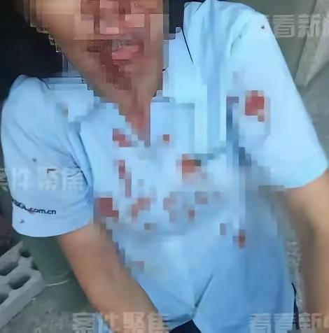 上海，外甥带5人上门围殴舅舅，舅妈激愤之下拿起强腐蚀性液体泼向施暴者，致对方10